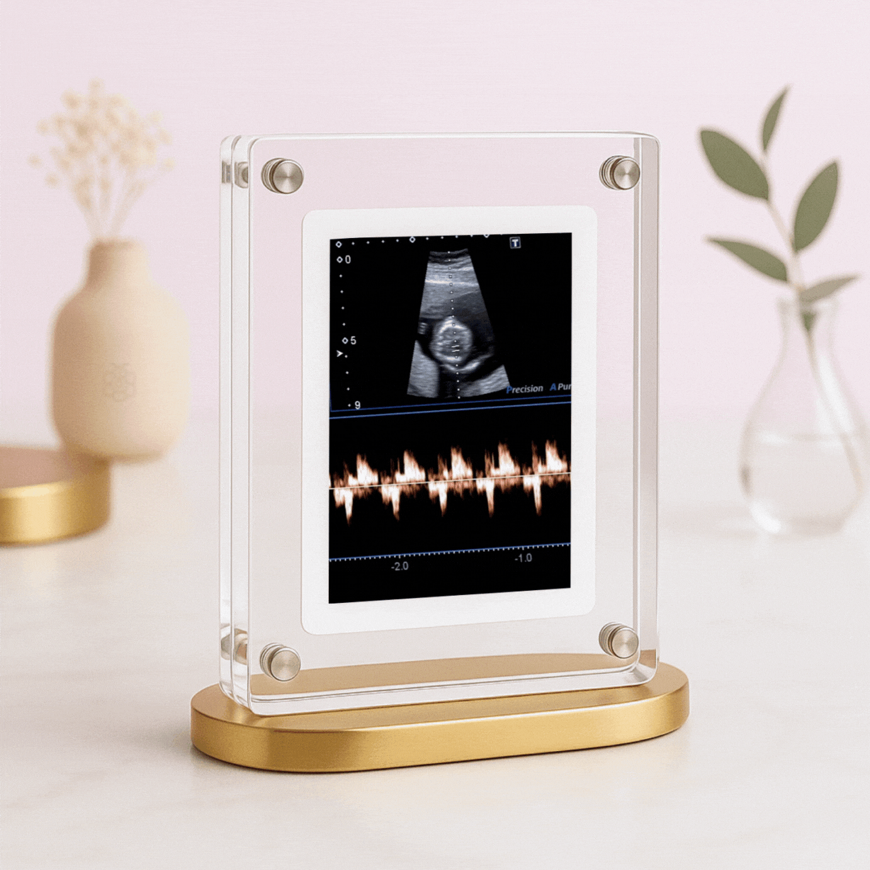 LoopFrame™ - Baby Video Frame