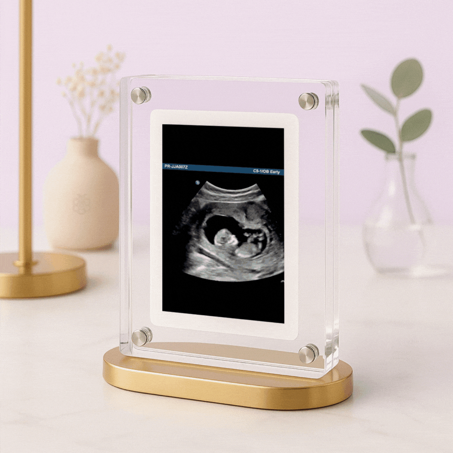 LoopFrame™ - Baby Video Frame
