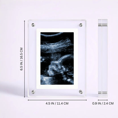 LoopFrame™ - Baby Video Frame