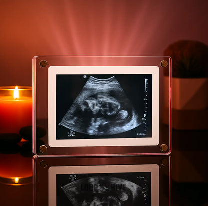 LoopFrame™ - Baby Video Frame